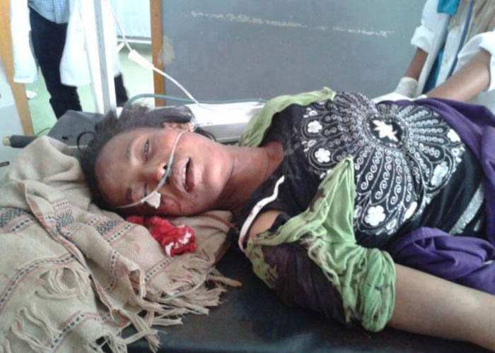 Victim of the shooting of the TPLF secuirty forces. Students killed by federal police. የዩኒቨርሲቲ ተማሪዎች ተገደሉ፣ ተደበደቡ Victim of the shooting of the TPLF secuirty forces. Students killed by federal police. የዩኒቨርሲቲ ተማሪዎች ተገደሉ፣ ተደበደቡ